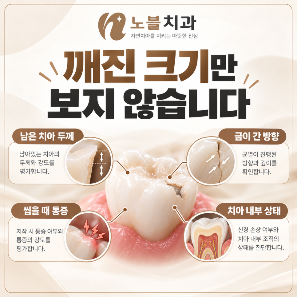 수원치과에서 치아가 깨졌을 때, 레진과 크라운은 어떻게 다를까요?