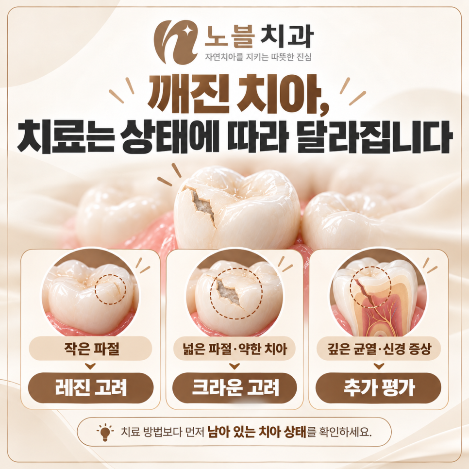 수원치과에서 치아가 깨졌을 때, 레진과 크라운은 어떻게 다를까요?