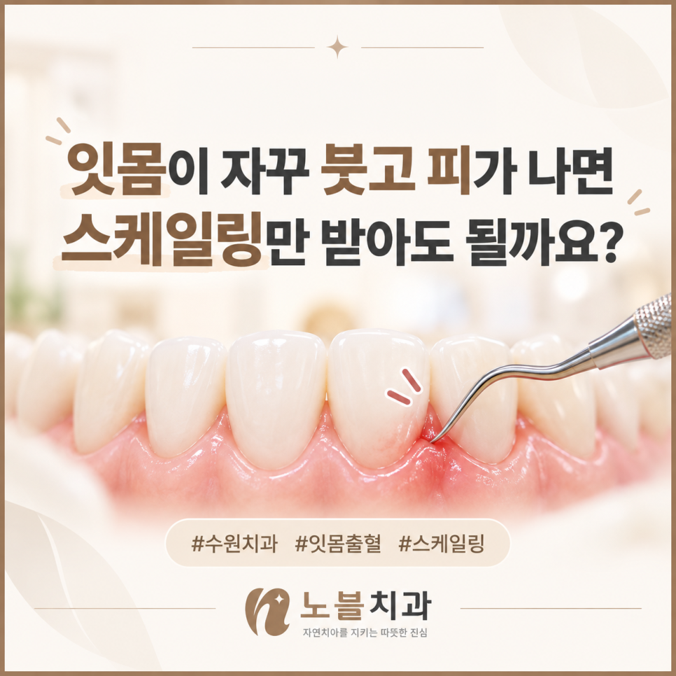 수원치과에서 잇몸이 자꾸 붓고 피가 나면 스케일링만 받아도 될까요?
