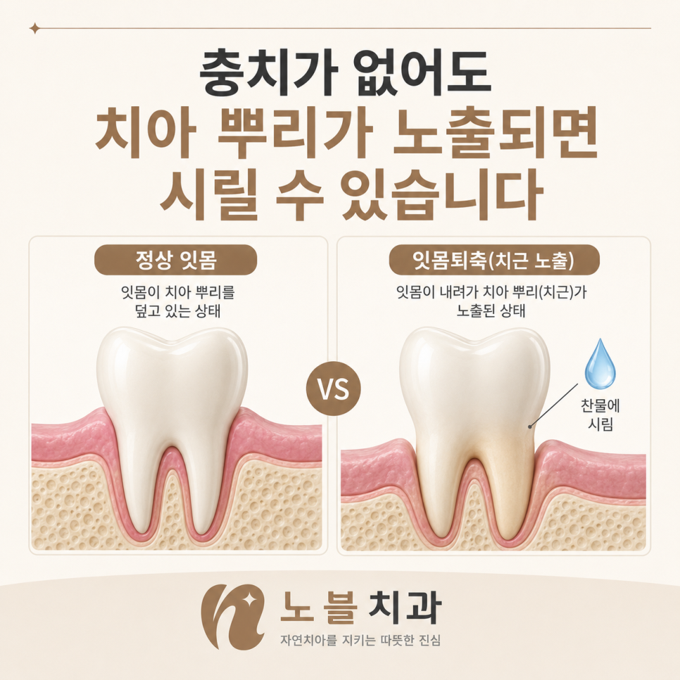 찬물에 시린 원인은 치아 안쪽에만 있는 것이 아닙니다.