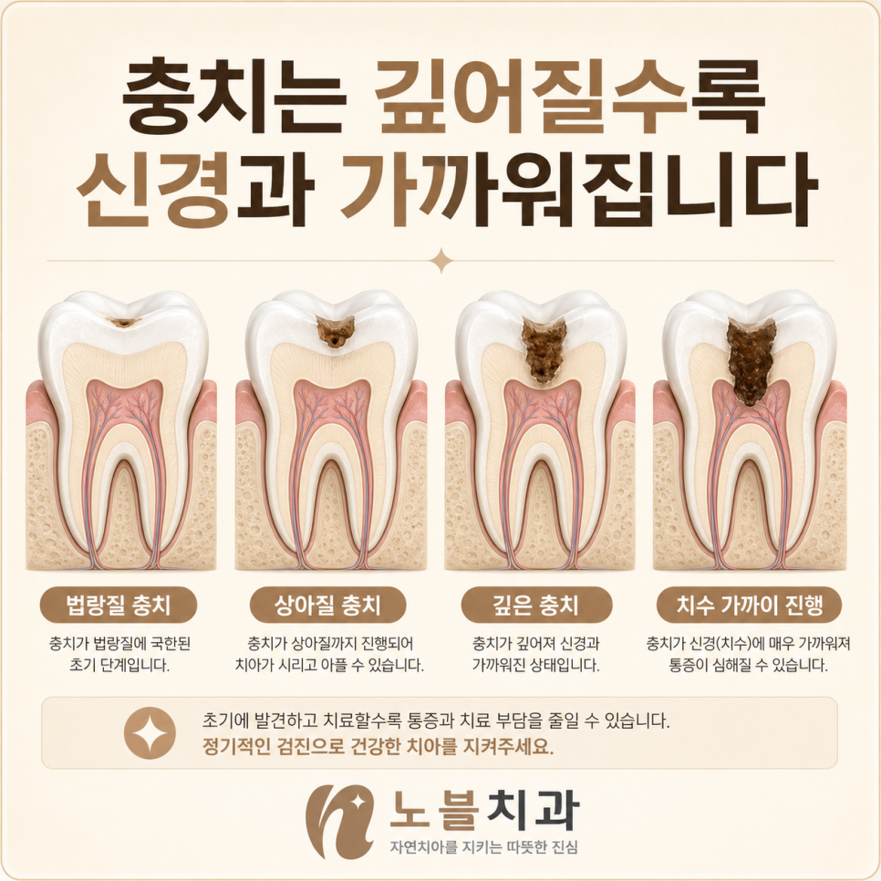깊이를 확인한 다음 신경이 어떻게 반응하는지 살펴봅니다.