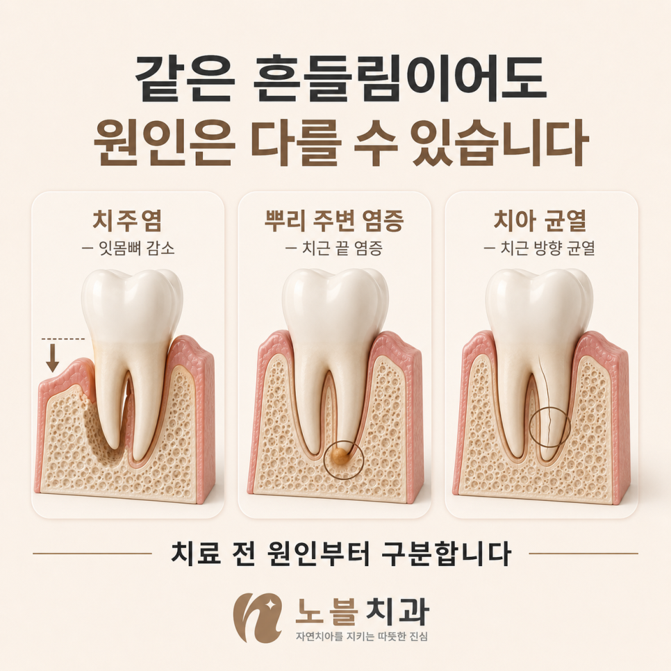 치료 전에는 흔들림의 원인부터 구분합니다.