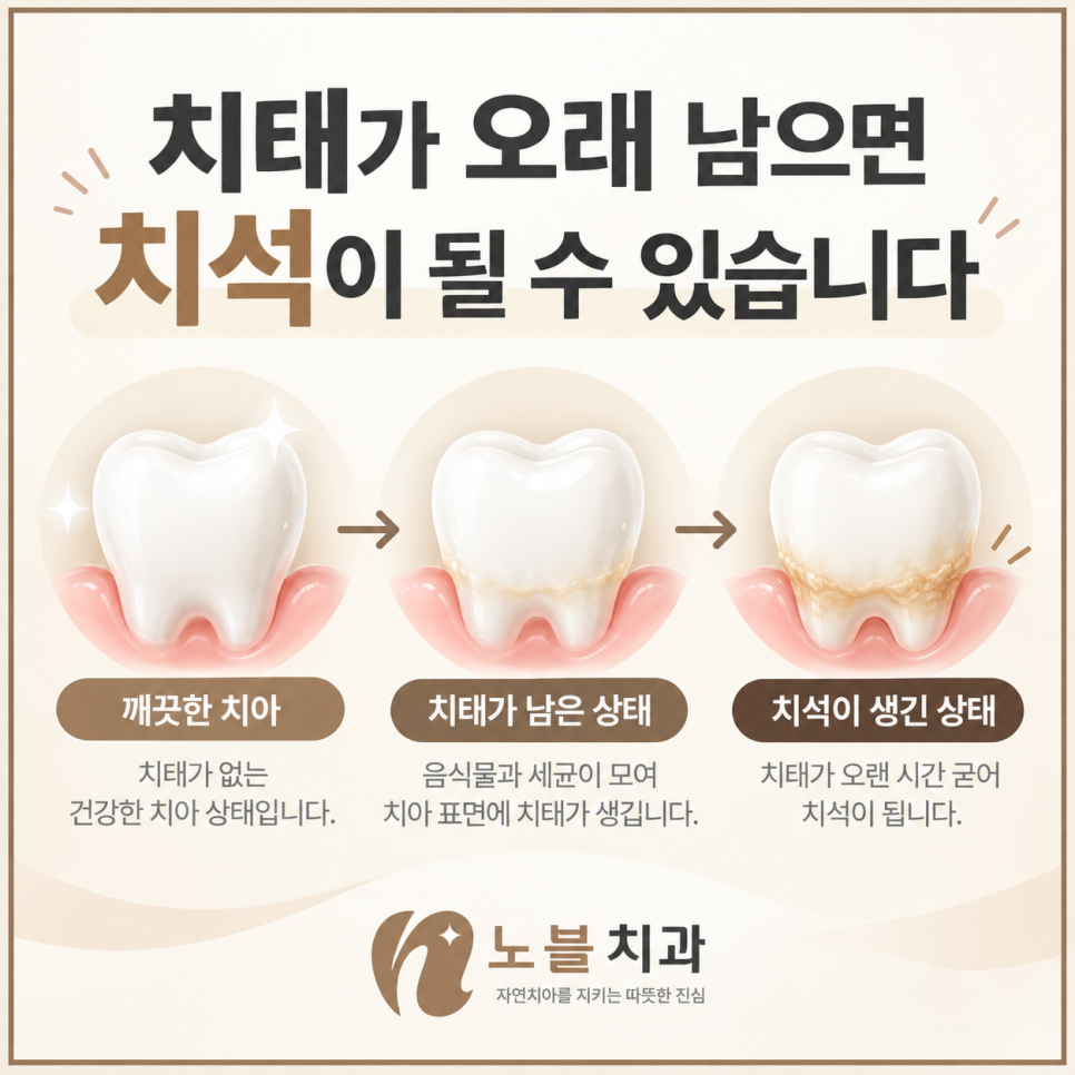 수원치과에서 잇몸이 자꾸 붓고 피가 나면 스케일링만 받아도 될까요?