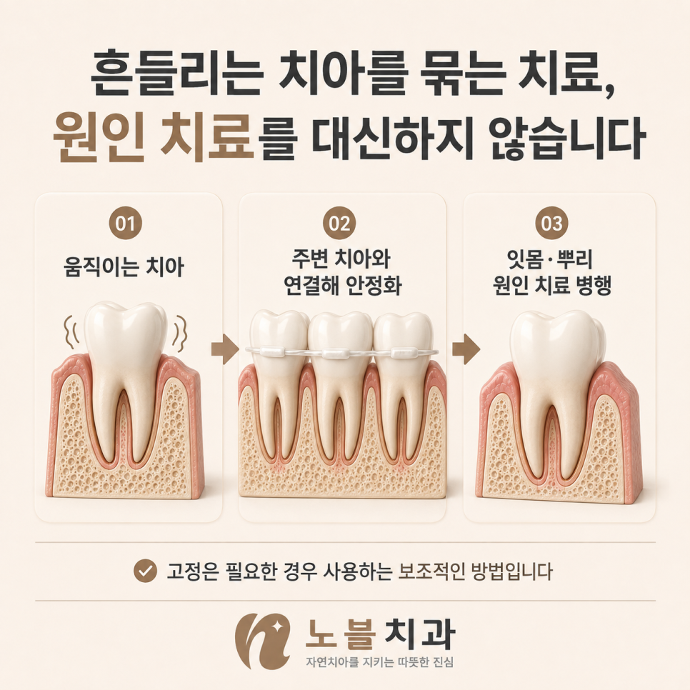 고정은 필요한 경우 사용하는 보조적인 방법입니다.