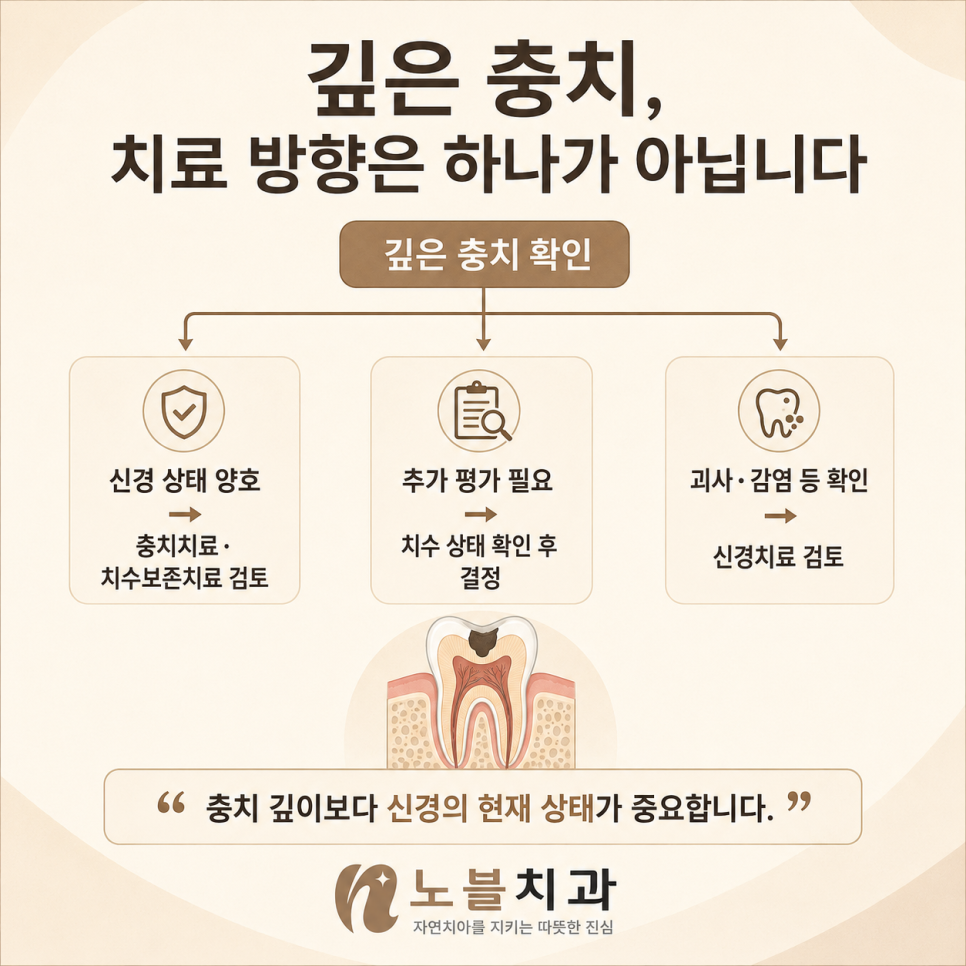 충치 깊이보다 신경의 현재 상태가 중요합니다.