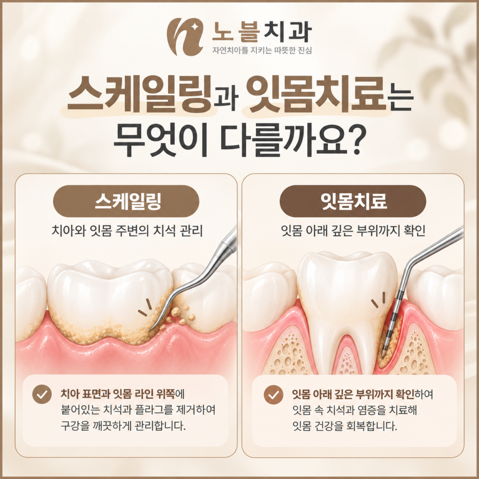 수원치과에서 잇몸이 자꾸 붓고 피가 나면 스케일링만 받아도 될까요?