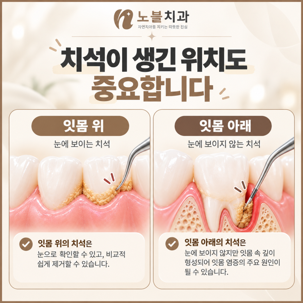 수원치과에서 잇몸이 자꾸 붓고 피가 나면 스케일링만 받아도 될까요?