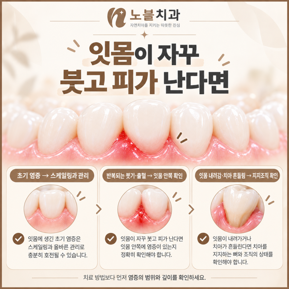 수원치과에서 잇몸이 자꾸 붓고 피가 나면 스케일링만 받아도 될까요?
