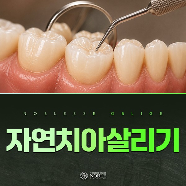 자연치아 보존 진료