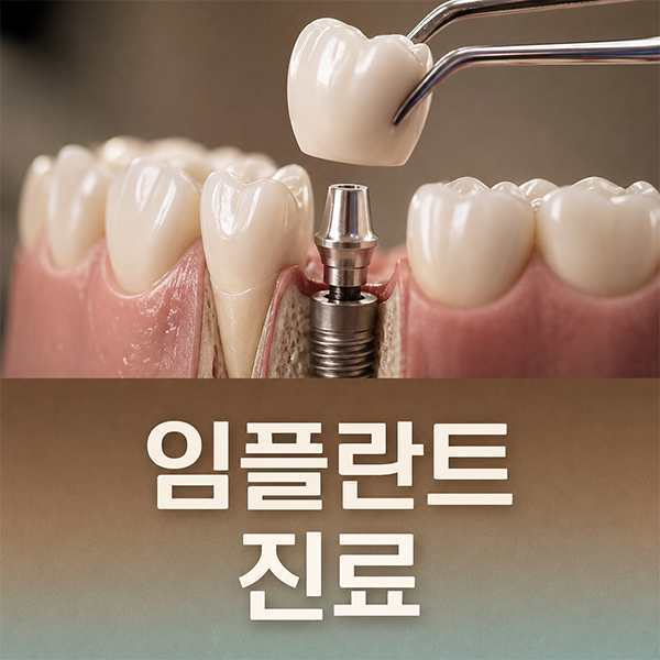 수원 임플란트 진료 안내